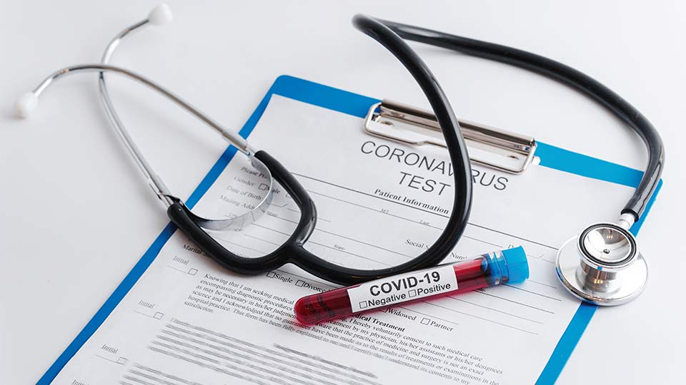 Соопштение за цена за тестови за Коронавирусот Covid – 19